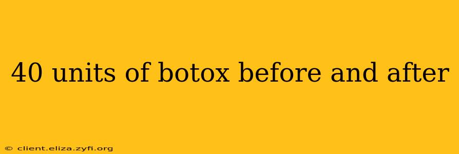40 units of botox before and after