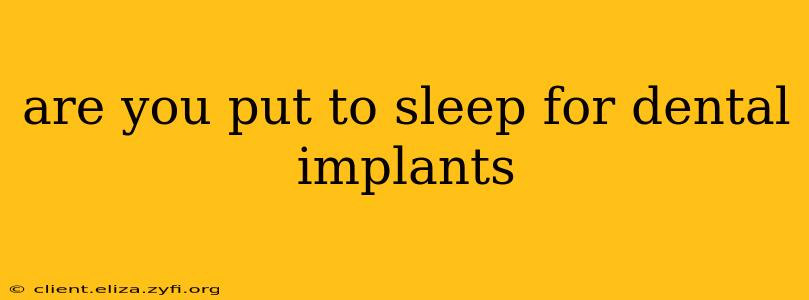 are you put to sleep for dental implants
