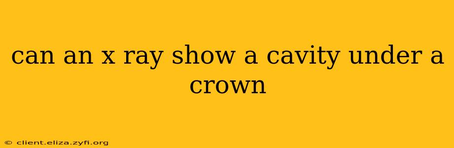 can an x ray show a cavity under a crown