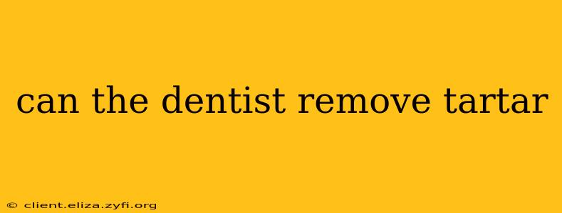 can the dentist remove tartar