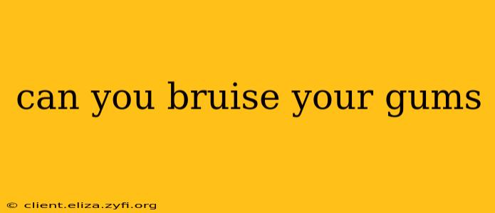 can you bruise your gums