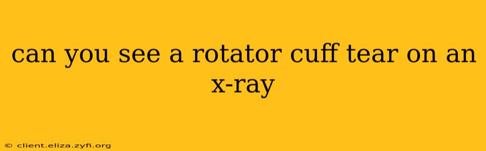 can you see a rotator cuff tear on an x-ray