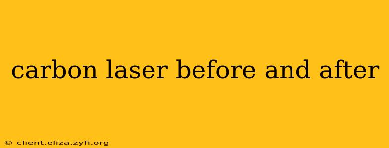 carbon laser before and after