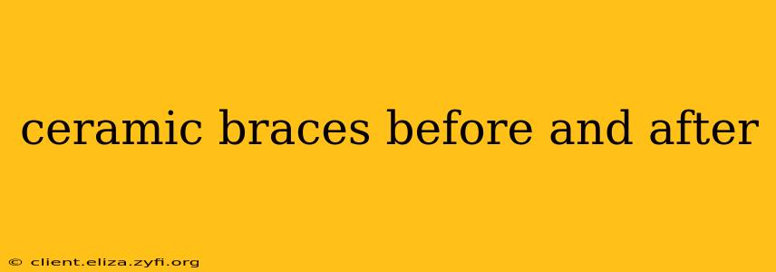 ceramic braces before and after