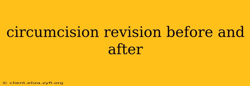 circumcision revision before and after