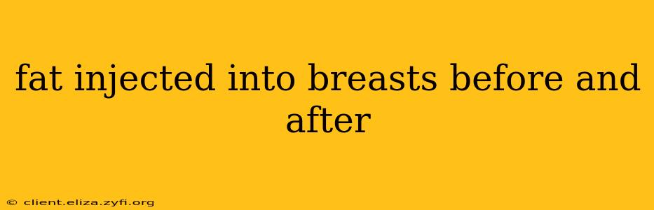 fat injected into breasts before and after
