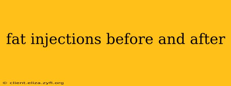 fat injections before and after