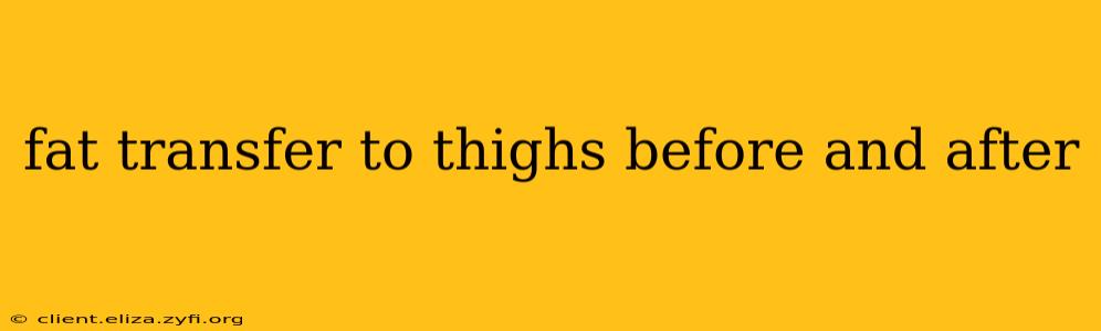 fat transfer to thighs before and after