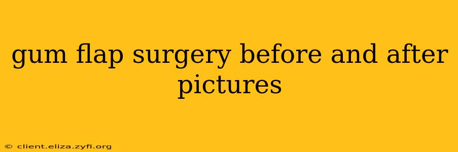 gum flap surgery before and after pictures