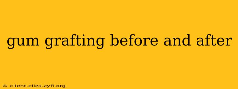 gum grafting before and after