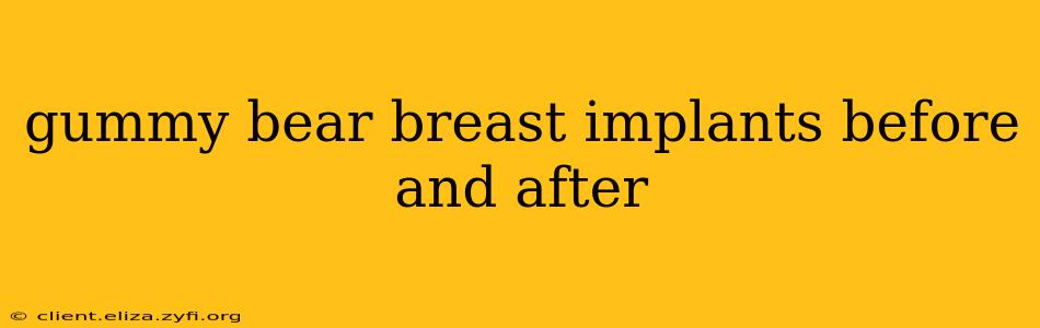 gummy bear breast implants before and after