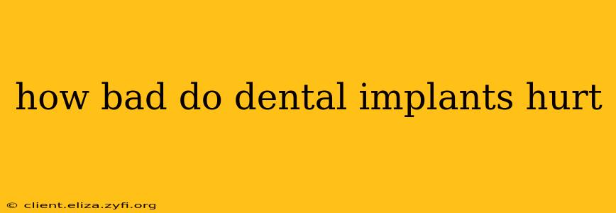 how bad do dental implants hurt