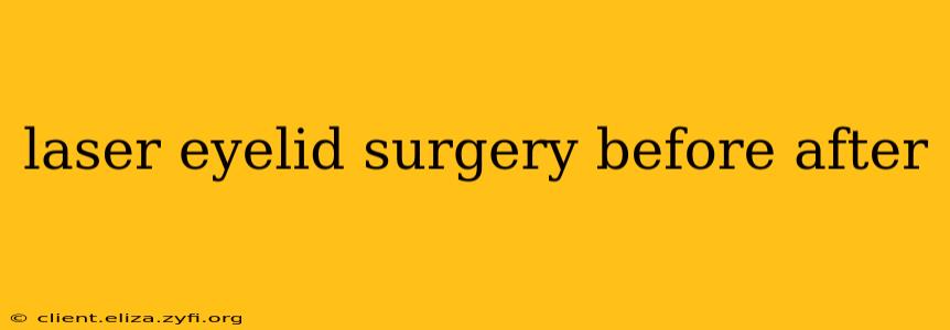 laser eyelid surgery before after