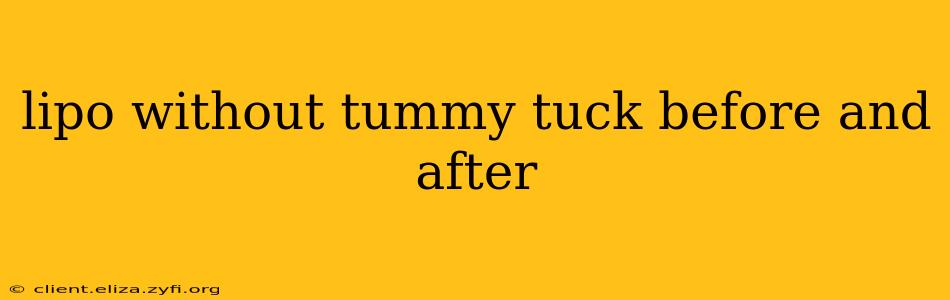 lipo without tummy tuck before and after