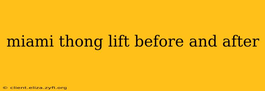 miami thong lift before and after