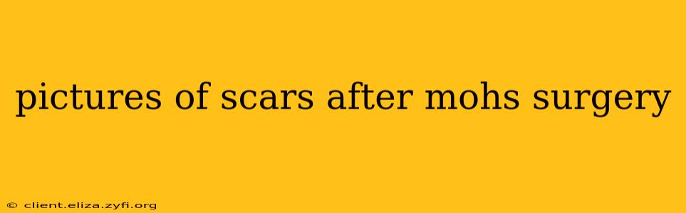 pictures of scars after mohs surgery