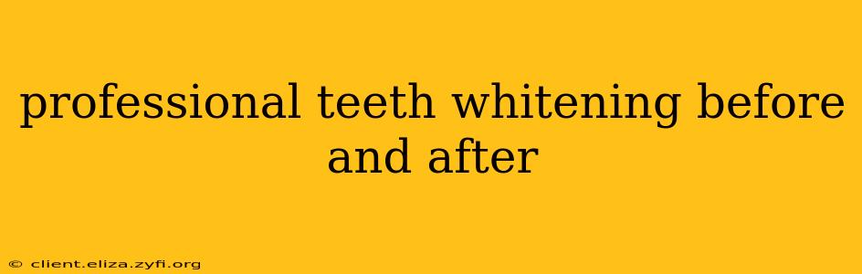 professional teeth whitening before and after