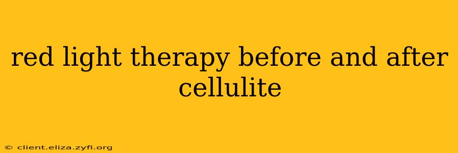 red light therapy before and after cellulite