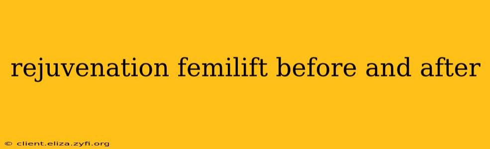 rejuvenation femilift before and after