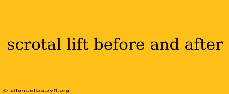 scrotal lift before and after