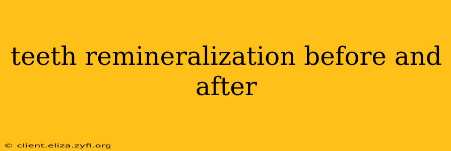 teeth remineralization before and after