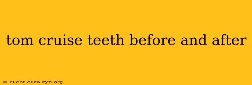 tom cruise teeth before and after