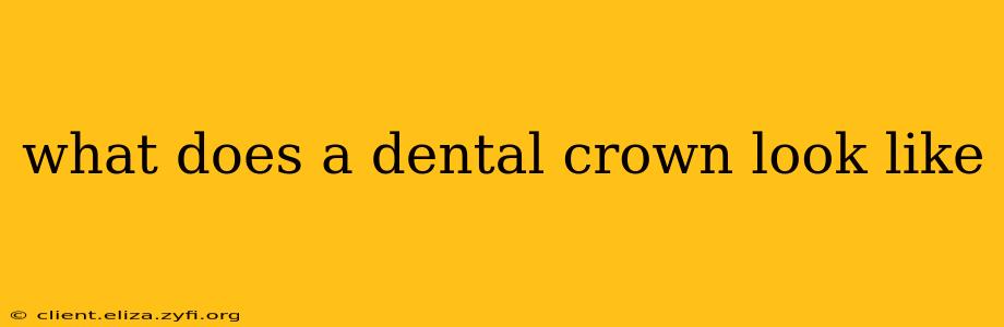 what does a dental crown look like