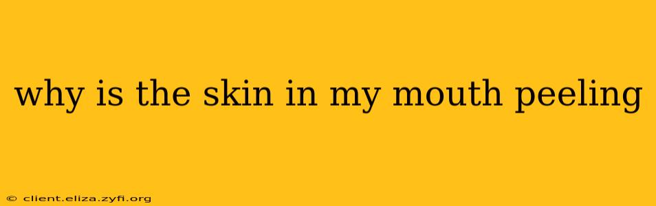 why is the skin in my mouth peeling